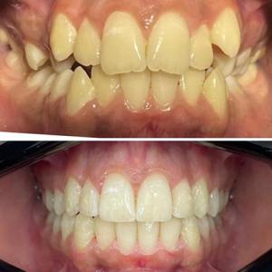 before-after-03
