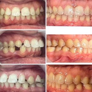 before-after-04