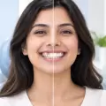 Can Crooked Teeth Be Fixed Without Extraction? Assessment and Treatment Options