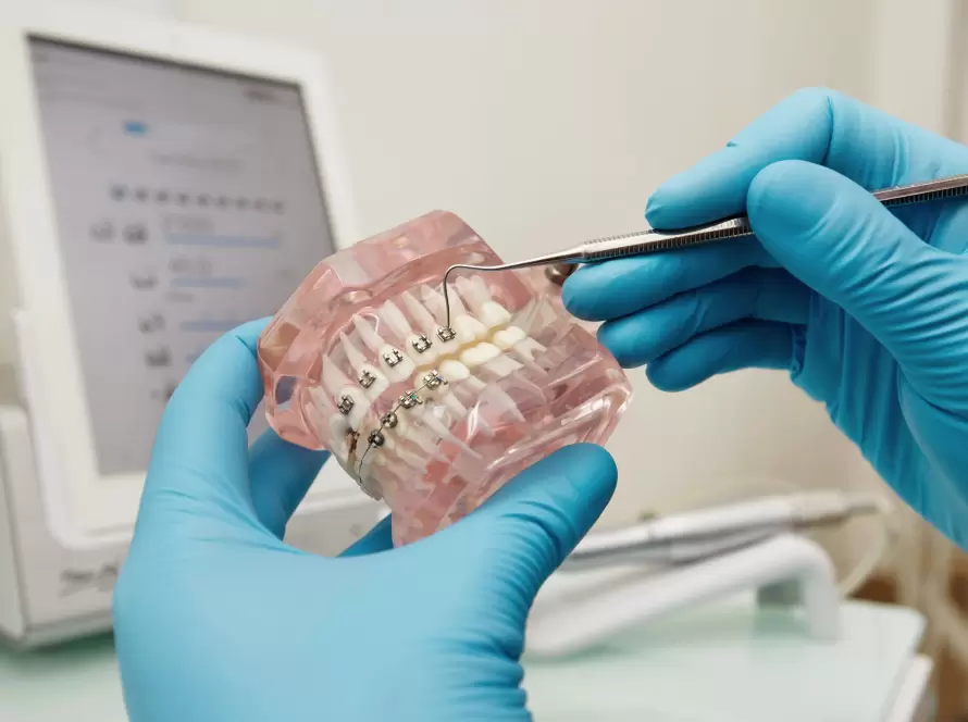 Orthodontic specialist showing metal braces on a dental model to explain treatment for crooked and crowded teeth